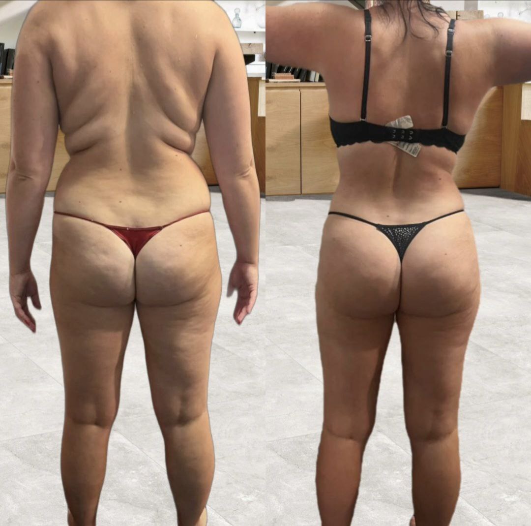 Céline - Transformation avant/après